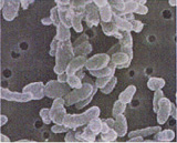 M-16Vビフィズス菌の顕微鏡写真