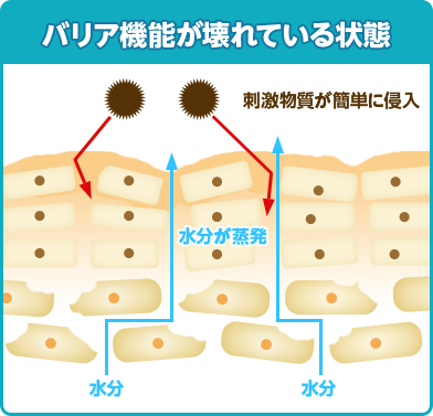 バリア機能が壊れている状態